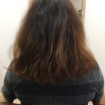 修正矯正のbefore、after。